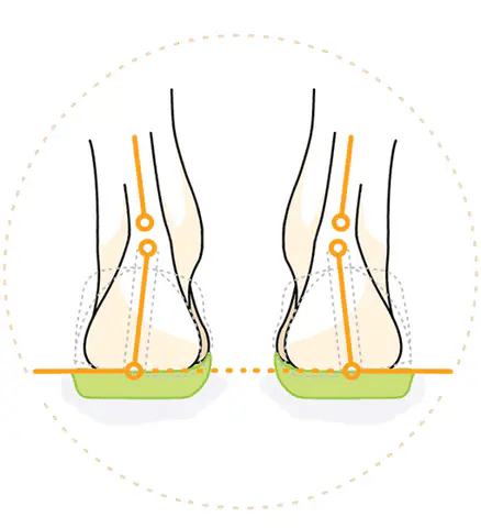Supiniert, Supination, 